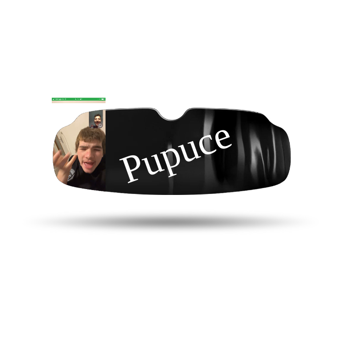 Protège-Dents Sur-Mesure personnalisé