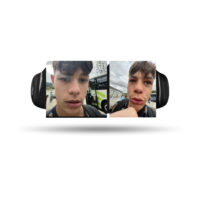 Protège-Dents Thermoformable personnalisé