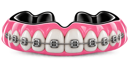 Protège-Dents Thermoformable- Bagues