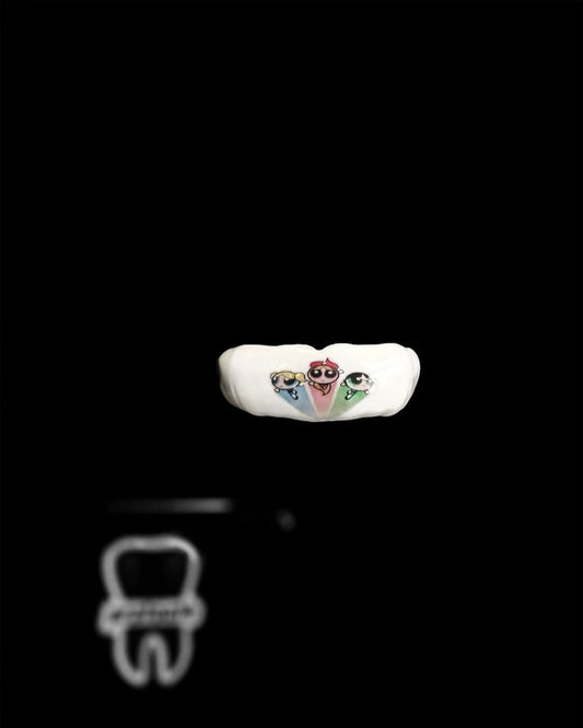 Protège-Dents Sur-Mesure pro - Super nana