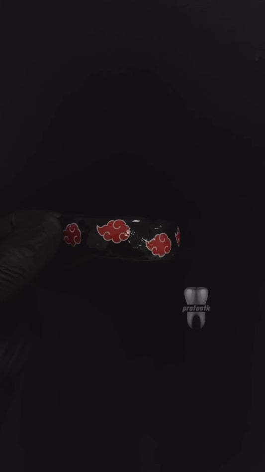 Protège-Dents Sur-Mesure pro - Akatsuki